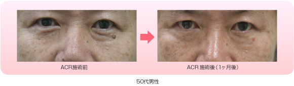 施術例写真 50代男性