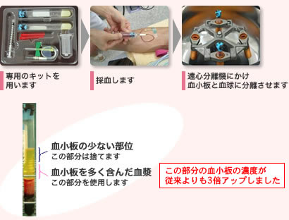 採血