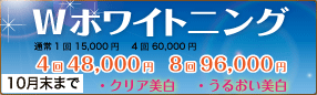 Wホワイトニング