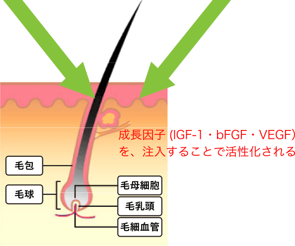 毛髪再生（メソライン・ヘア－注入療法）