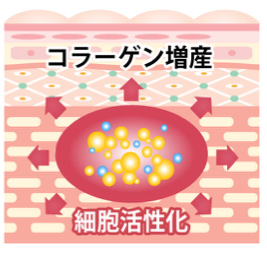 プロファイロの特徴
